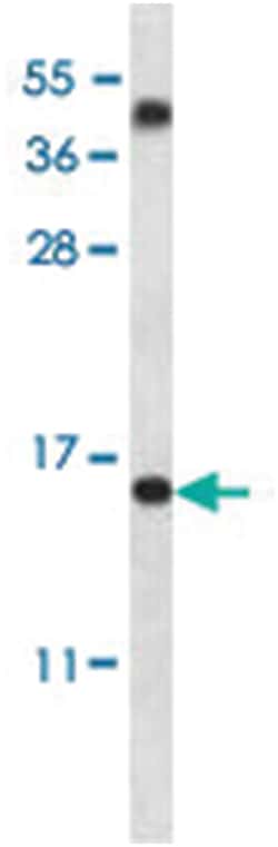 TM4SF18, Rabbit, Polyclonal Antibody, Abnova 400 &mu;L | Buy Online | Abnova Corporation | Fisher Scientific