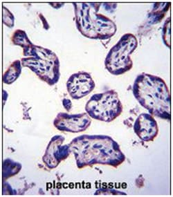 TM4SF18, Rabbit, Polyclonal Antibody, Abnova 400 &mu;L | Buy Online | Abnova Corporation | Fisher Scientific