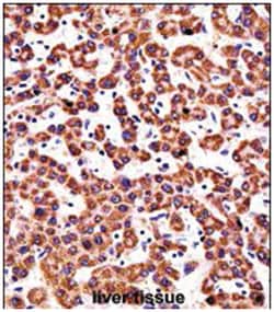 CYP2D6 Rabbit anti-Human, Polyclonal Antibody, Abnova 400 &mu;L | Buy Online | Abnova Corporation | Fisher Scientific