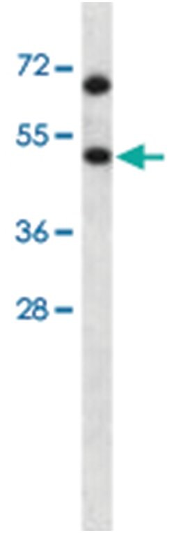 HSFX1, Rabbit, Polyclonal Antibody, Abnova 400 &mu;L | Buy Online | Abnova Corporation | Fisher Scientific