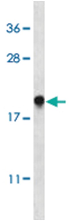 TMEM85, Rabbit, Polyclonal Antibody, Abnova 400 &mu;L | Buy Online | Abnova Corporation | Fisher Scientific