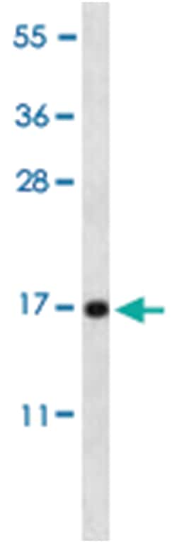 PLA2G5, Rabbit, Polyclonal Antibody, Abnova 400&mu;L; Unlabeled:Antibodies,