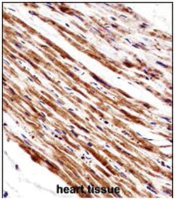 PLA2G5, Rabbit, Polyclonal Antibody, Abnova 400&mu;L; Unlabeled:Antibodies,