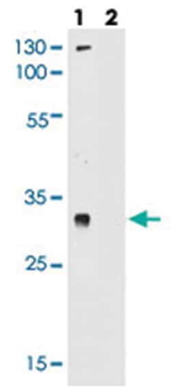 LOC728137, Rabbit, Polyclonal Antibody, Abnova 400 &mu;L | Buy Online | Abnova Corporation | Fisher Scientific