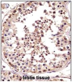 LOC728137, Rabbit, Polyclonal Antibody, Abnova 400 &mu;L | Buy Online | Abnova Corporation | Fisher Scientific
