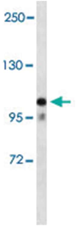 MOV10, Rabbit, Polyclonal Antibody, Abnova 400 &mu;L | Buy Online | Abnova Corporation | Fisher Scientific