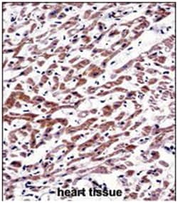 MOV10, Rabbit, Polyclonal Antibody, Abnova 400 &mu;L | Buy Online | Abnova Corporation | Fisher Scientific