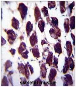 POLG, Rabbit, Polyclonal Antibody, Abnova 400 &mu;L | Buy Online | Abnova Corporation | Fisher Scientific