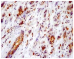 KARS Rabbit anti-Human, Mouse, Polyclonal Antibody, Abnova 100 &mu;L | Buy Online | Abnova Corporation | Fisher Scientific