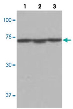 KARS Rabbit anti-Human, Mouse, Polyclonal Antibody, Abnova 100 &mu;L | Buy Online | Abnova Corporation | Fisher Scientific