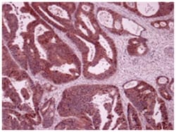 LARS Rabbit anti-Human, Mouse, Polyclonal Antibody, Abnova 100 &mu;L | Buy Online | Abnova Corporation | Fisher Scientific