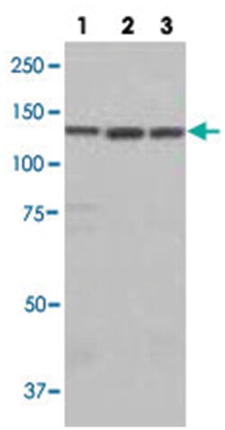 LARS Rabbit anti-Human, Mouse, Polyclonal Antibody, Abnova 100 &mu;L | Buy Online | Abnova Corporation | Fisher Scientific