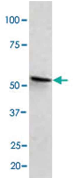YARS Rabbit anti-Human, Mouse, Polyclonal Antibody, Abnova 100 &mu;L | Buy Online | Abnova Corporation | Fisher Scientific