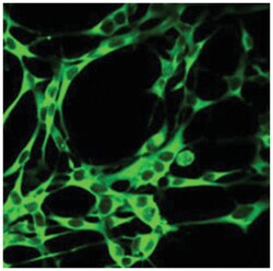YARS Rabbit anti-Human, Mouse, Polyclonal Antibody, Abnova 100 &mu;L | Buy Online | Abnova Corporation | Fisher Scientific
