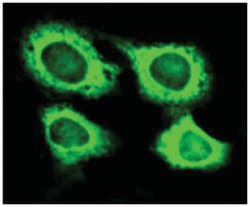 WARS, Rabbit, Polyclonal Antibody, Abnova 100&mu;L; Unlabeled:Antibodies,