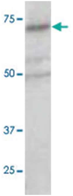 RARS, Rabbit, Polyclonal Antibody, Abnova 100 &mu;L | Buy Online | Abnova Corporation | Fisher Scientific