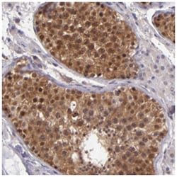TAF7L, Rabbit, Polyclonal Antibody, Abnova 100 &mu;L | Buy Online | Abnova Corporation | Fisher Scientific