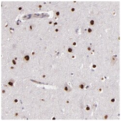 NUP62CL, Rabbit, Polyclonal Antibody, Abnova 100 &mu;L | Buy Online | Abnova Corporation | Fisher Scientific