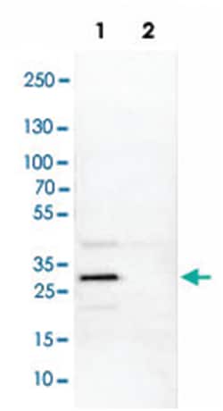 SIX1, Rabbit, Polyclonal Antibody, Abnova 100 &mu;L | Buy Online | Abnova Corporation | Fisher Scientific