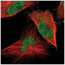 SIX1, Rabbit, Polyclonal Antibody, Abnova 100 &mu;L | Buy Online | Abnova Corporation | Fisher Scientific
