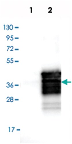 SIX1, Rabbit, Polyclonal Antibody, Abnova 100 &mu;L | Buy Online | Abnova Corporation | Fisher Scientific