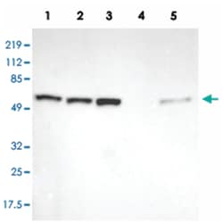 GPKOW, Rabbit, Polyclonal Antibody, Abnova 100 &mu;L | Buy Online | Abnova Corporation | Fisher Scientific