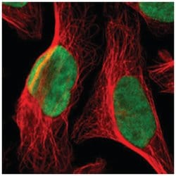 GPKOW, Rabbit, Polyclonal Antibody, Abnova 100 &mu;L | Buy Online | Abnova Corporation | Fisher Scientific