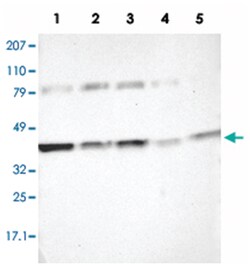 IDH3G, Rabbit, Polyclonal Antibody, Abnova 100&mu;L; Unlabeled:Antibodies,