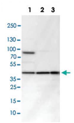 IDH3G, Rabbit, Polyclonal Antibody, Abnova 100&mu;L; Unlabeled:Antibodies,