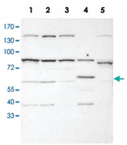 FGR Rabbit anti-Human, Polyclonal Antibody, Abnova 100&mu;L; Unlabeled:Antibodies,
