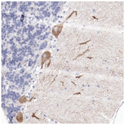 FGR Rabbit anti-Human, Polyclonal Antibody, Abnova 100&mu;L; Unlabeled:Antibodies,