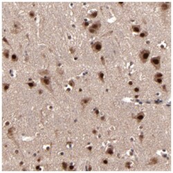 NXF5, Rabbit, Polyclonal Antibody, Abnova 100 &mu;L | Buy Online | Abnova Corporation | Fisher Scientific