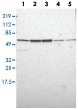 CALR Rabbit anti-Human, Mouse, Rat, Polyclonal Antibody, Abnova 100 &mu;L | Buy Online | Abnova Corporation | Fisher Scientific