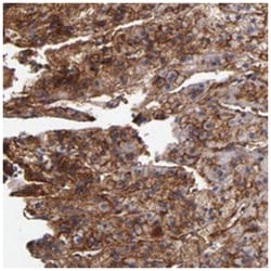 PLSCR4, Rabbit, Polyclonal Antibody, Abnova 100 &mu;L | Buy Online | Abnova Corporation | Fisher Scientific