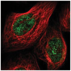 PLSCR4, Rabbit, Polyclonal Antibody, Abnova 100 &mu;L | Buy Online | Abnova Corporation | Fisher Scientific