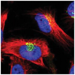 GOLIM4 Rabbit anti-Human, Polyclonal Antibody, Abnova 100&mu;L; Unlabeled:Antibodies,