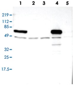 MAOB, Rabbit, Polyclonal Antibody, Abnova 100&mu;L; Unlabeled:Antibodies,