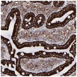 MAOB, Rabbit, Polyclonal Antibody, Abnova 100&mu;L; Unlabeled:Antibodies,