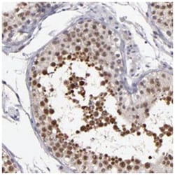 OTUB2, Rabbit, Polyclonal Antibody, Abnova 100 &mu;L | Buy Online | Abnova Corporation | Fisher Scientific