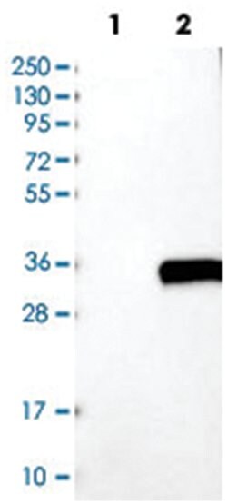 C1QA, Rabbit, Polyclonal Antibody, Abnova 100 &mu;L | Buy Online | Abnova Corporation | Fisher Scientific