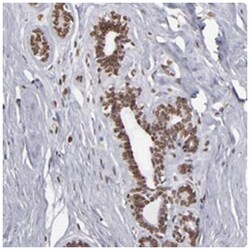 KIAA0020, Rabbit, Polyclonal Antibody, Abnova 100 &mu;L | Buy Online | Abnova Corporation | Fisher Scientific