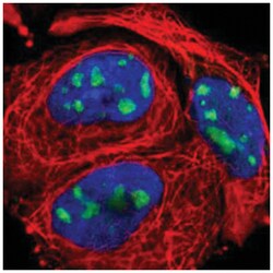 KIAA0020, Rabbit, Polyclonal Antibody, Abnova 100 &mu;L | Buy Online | Abnova Corporation | Fisher Scientific