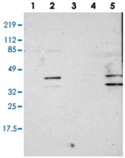 SLMAP Rabbit anti-Human, Polyclonal Antibody, Abnova 100&mu;L; Unlabeled:Antibodies,