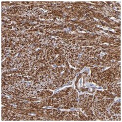 SLMAP Rabbit anti-Human, Polyclonal Antibody, Abnova 100&mu;L; Unlabeled:Antibodies,