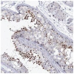 TRPC3 Rabbit, Polyclonal Antibody, Abnova 100&mu;L; Unlabeled:Antibodies,