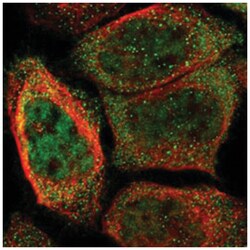 ORAI3 Rabbit, Polyclonal Antibody, Abnova 100 &mu;L | Buy Online | Abnova Corporation | Fisher Scientific