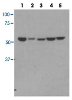 DARS, Rabbit, Polyclonal Antibody, Abnova 100 &mu;L | Buy Online | Abnova Corporation | Fisher Scientific