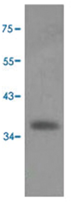SCYE1, Rabbit, Polyclonal Antibody, Abnova 100 &mu;L | Buy Online | Abnova Corporation | Fisher Scientific
