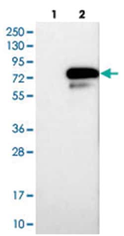 HNF1B, Rabbit, Polyclonal Antibody, Abnova 100&mu;L; Unlabeled:Antibodies,