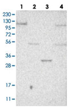 SULT1B1, Rabbit, Polyclonal Antibody, Abnova 100&mu;L; Unlabeled:Antibodies,